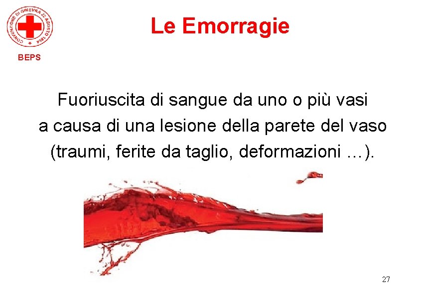 Le Emorragie BEPS Fuoriuscita di sangue da uno o più vasi a causa di