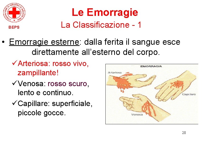 Le Emorragie BEPS La Classificazione - 1 • Emorragie esterne: dalla ferita il sangue