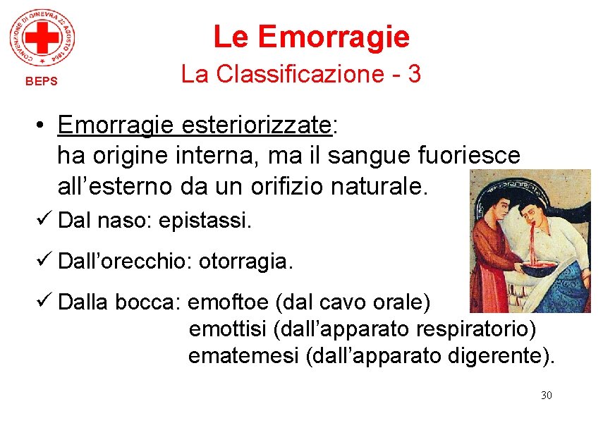Le Emorragie BEPS La Classificazione - 3 • Emorragie esteriorizzate: ha origine interna, ma