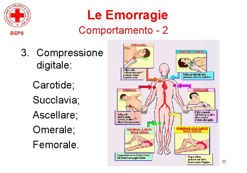Le Emorragie BEPS Comportamento - 2 3. Compressione digitale: Carotide; Succlavia; Ascellare; Omerale; Femorale.