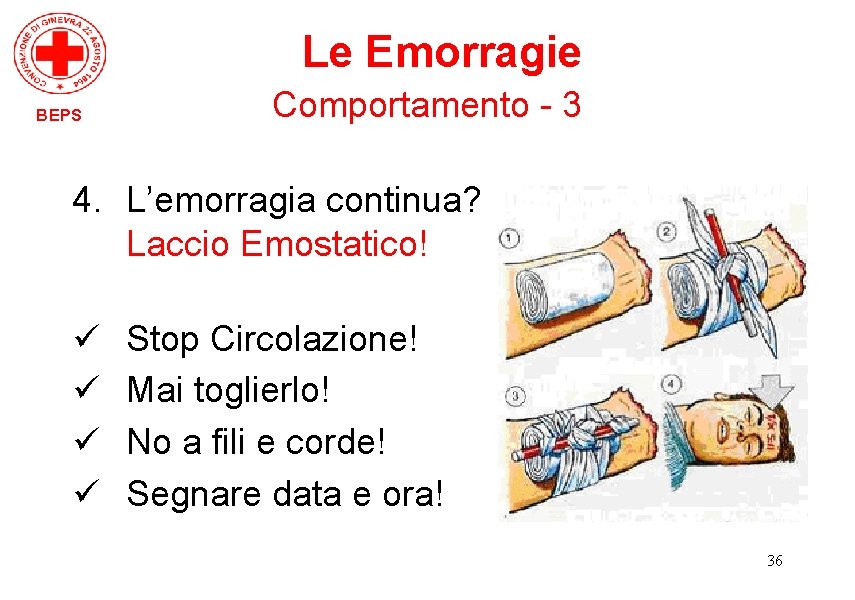 Le Emorragie BEPS Comportamento - 3 4. L’emorragia continua? Laccio Emostatico! ü ü Stop