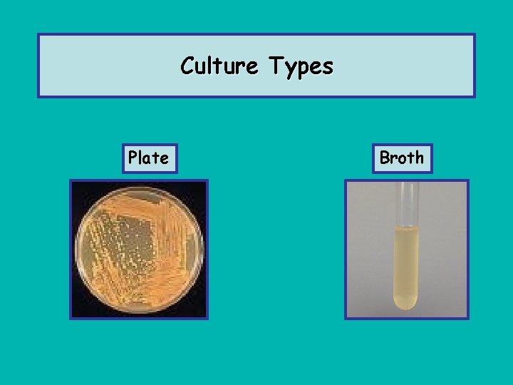 Culture Types Plate Broth 