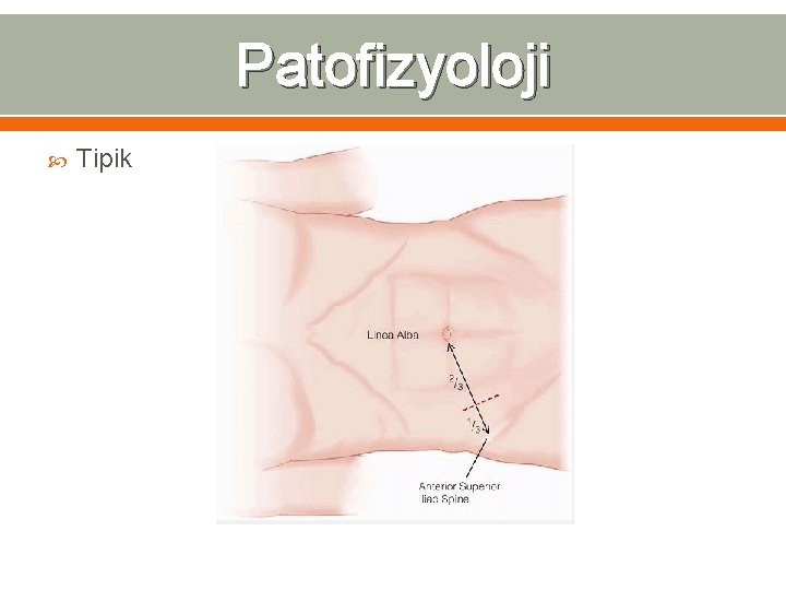 Patofizyoloji Tipik 