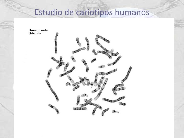 Estudio de cariotipos humanos 