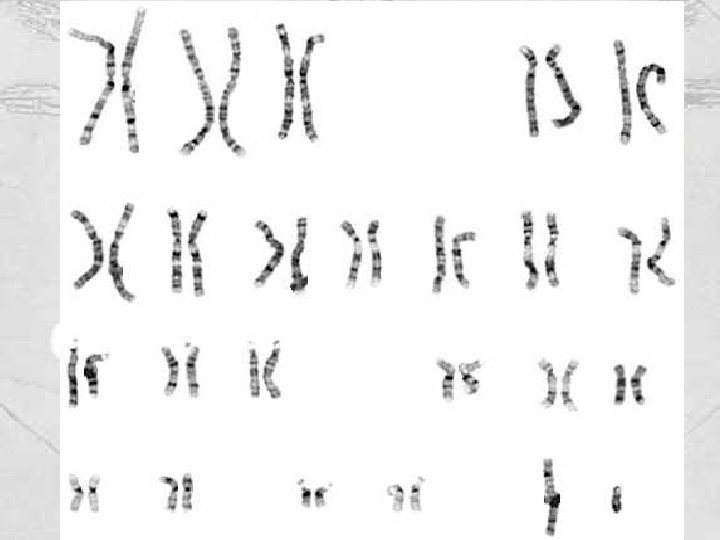 Estudio de cariotipos humanos 