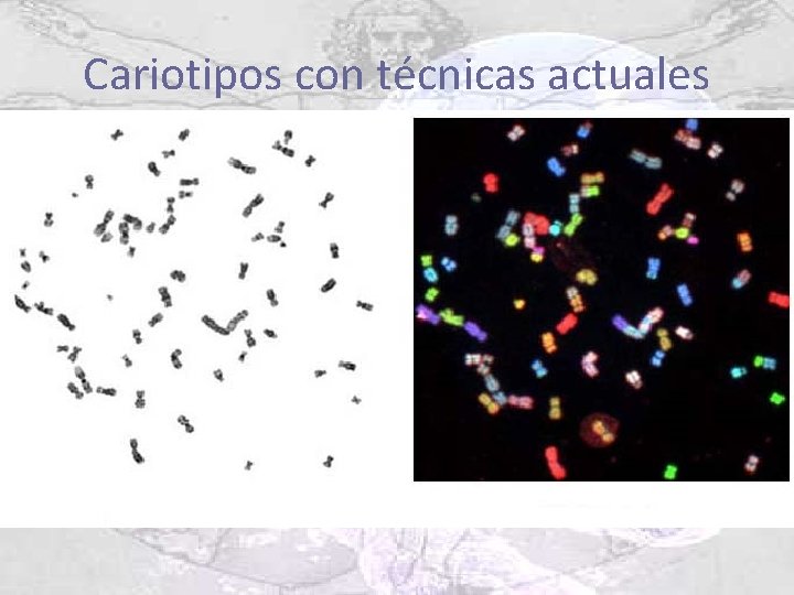 Cariotipos con técnicas actuales 