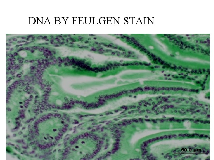 DNA BY FEULGEN STAIN 