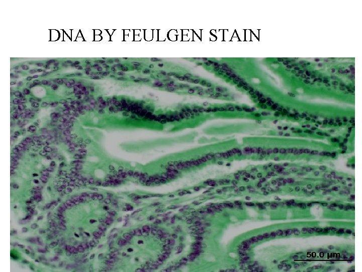 DNA BY FEULGEN STAIN 