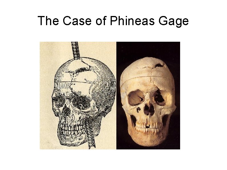 The Case of Phineas Gage 