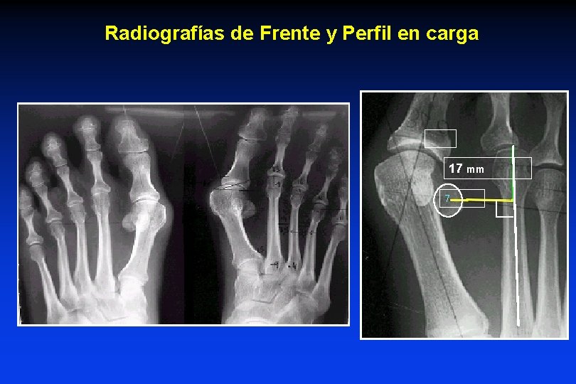 Radiografías de Frente y Perfil en carga 17 mm 7 