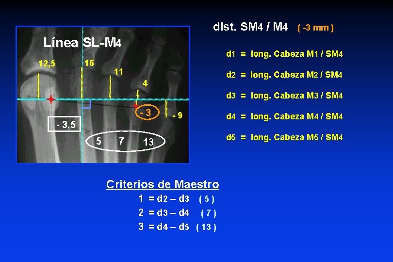dist. SM 4 / M 4 Línea SL-M 4 16 12, 5 ( -3