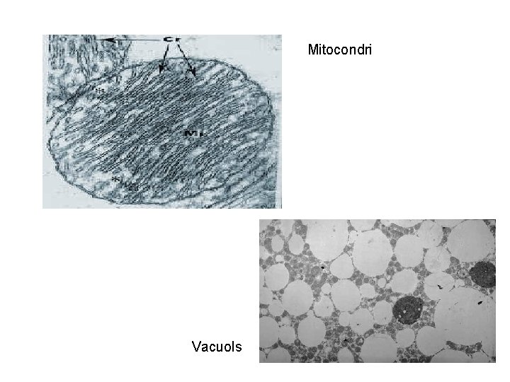 Mitocondri Vacuols 