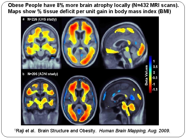 Genetic Analysis of Brain Images from 21 000