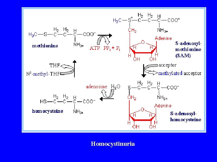Homocystinuria 
