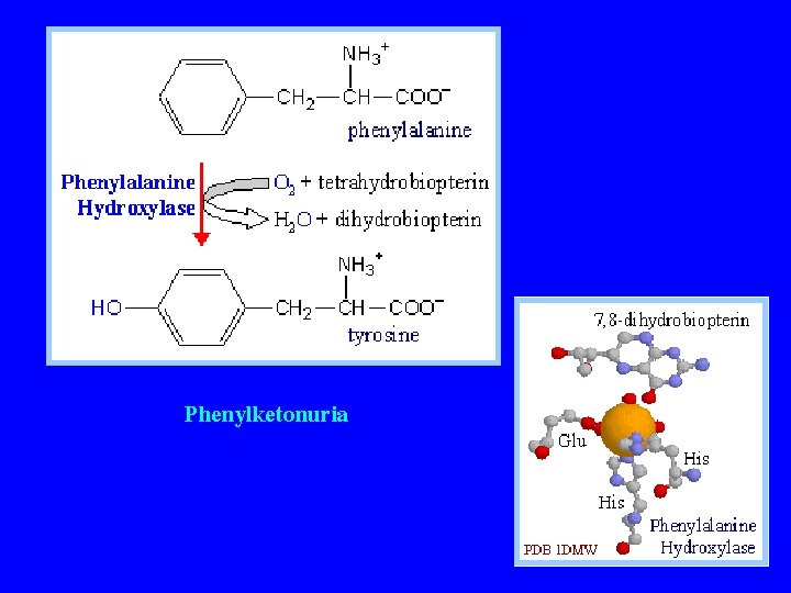 Phenylketonuria 