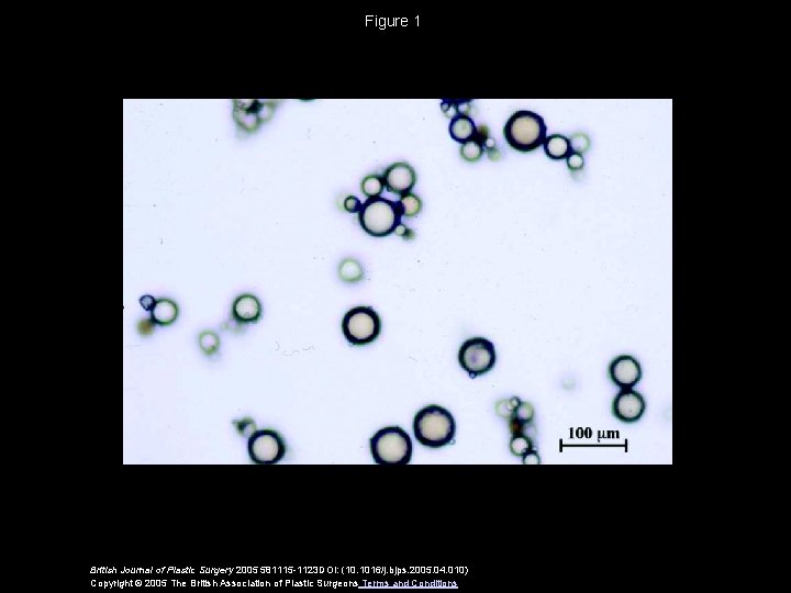 Figure 1 British Journal of Plastic Surgery 2005 581115 -1123 DOI: (10. 1016/j. bjps.