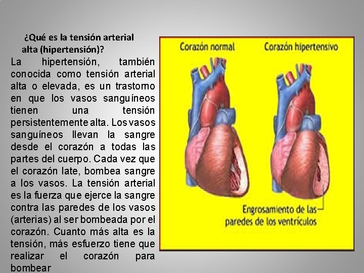 ¿Qué es la tensión arterial alta (hipertensión)? La hipertensión, también conocida como tensión arterial