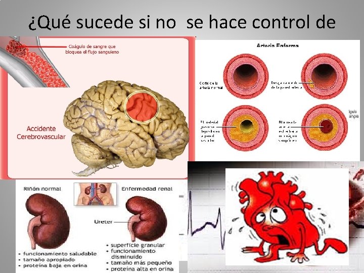 ¿Qué sucede si no se hace control de HTA. 