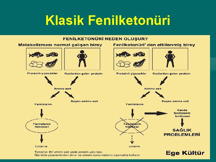 Klasik Fenilketonüri 