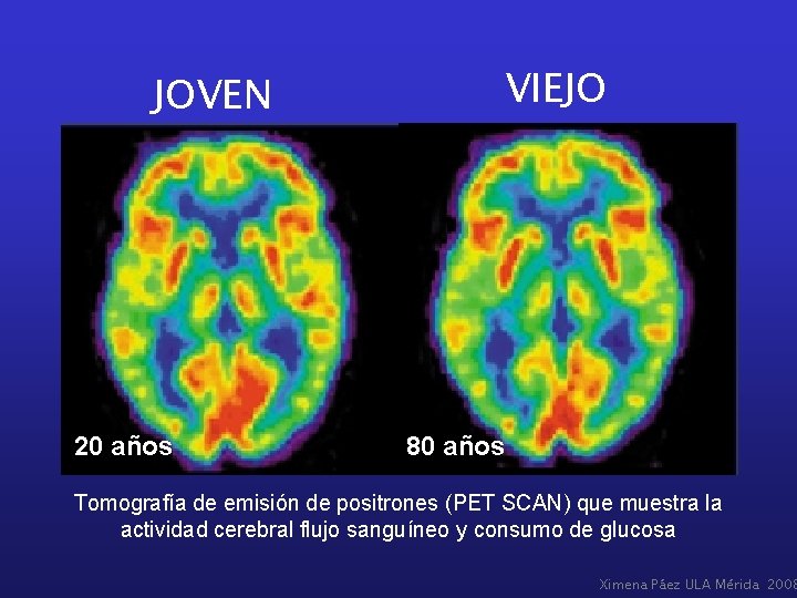 JOVEN 20 años VIEJO 80 años Tomografía de emisión de positrones (PET SCAN) que