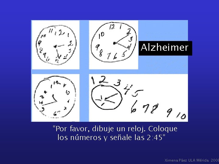 Alzheimer “Por favor, dibuje un reloj. Coloque los números y señale las 2: 45”