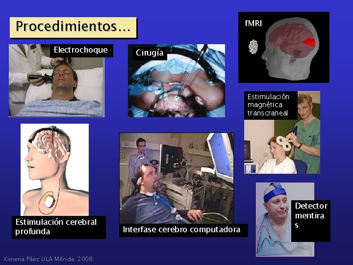 Procedimientos… Electrochoque f. MRI Cirugía Estimulación magnética transcraneal Estimulación cerebral profunda Ximena Páez ULA