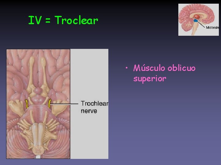 IV = Troclear • Músculo oblicuo superior 