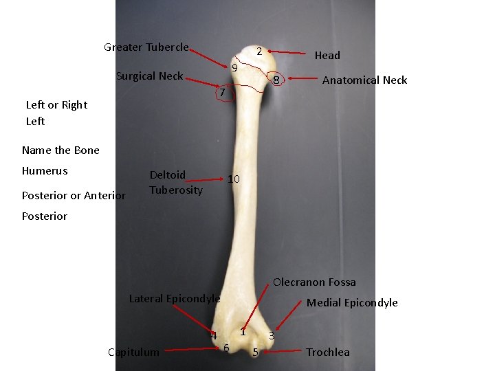 Greater Tubercle 2 9 Surgical Neck 8 7 Left or Right Left Head Anatomical