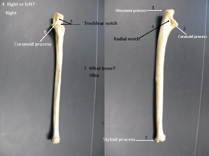 4 Right or left? Olecranon process Right 5 Trochlear notch 6 8 Coronoid process