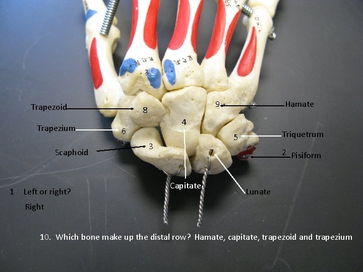 Trapezoid Trapezium Scaphoid 1 Left or right? 9 8 Hamate 4 6 Triquetrum 5