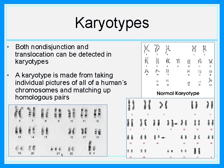 Karyotypes • Both nondisjunction and translocation can be detected in karyotypes • A karyotype