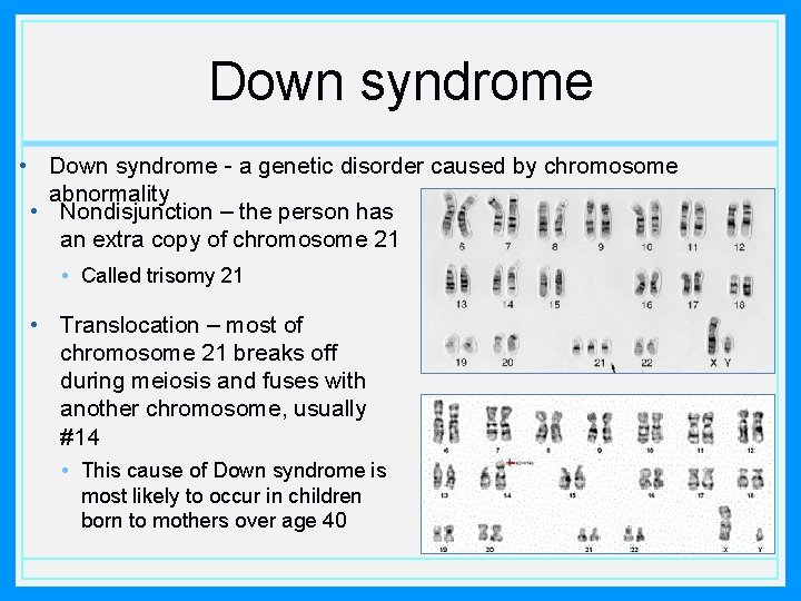 Down syndrome • Down syndrome - a genetic disorder caused by chromosome abnormality •
