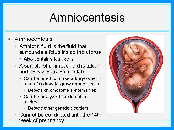 Amniocentesis • Amniotic fluid is the fluid that surrounds a fetus inside the uterus