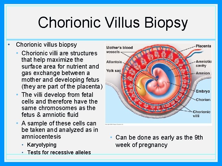 Chorionic Villus Biopsy • Chorionic villus biopsy • Chorionic villi are structures that help