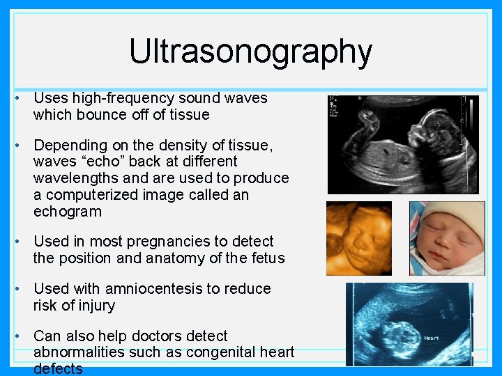 Ultrasonography • Uses high-frequency sound waves which bounce off of tissue • Depending on