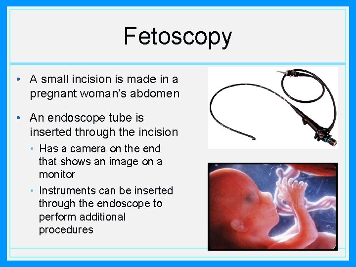 Fetoscopy • A small incision is made in a pregnant woman’s abdomen • An