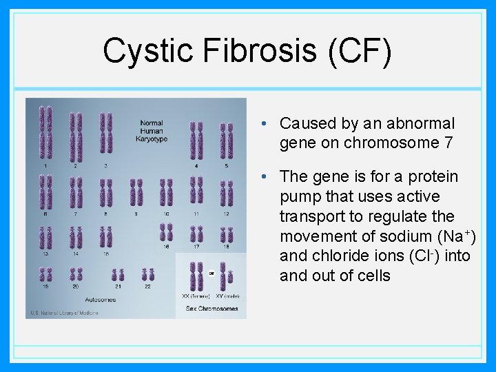 Cystic Fibrosis (CF) • Caused by an abnormal gene on chromosome 7 • The
