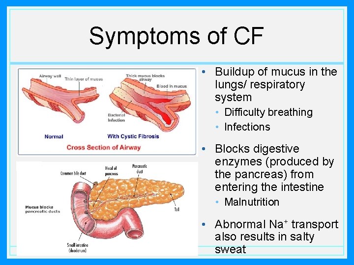 Symptoms of CF • Buildup of mucus in the lungs/ respiratory system • Difficulty