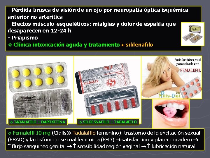 - Pérdida brusca de visión de un ojo por neuropatía óptica isquémica anterior no