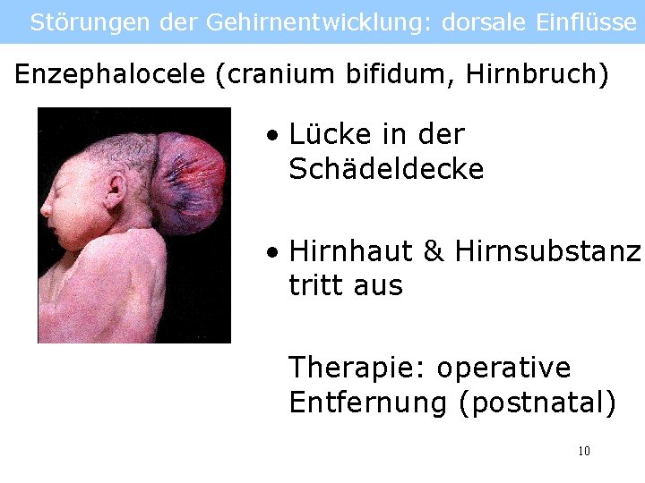 Störungen der Gehirnentwicklung: dorsale Einflüsse Enzephalocele (cranium bifidum, Hirnbruch) • Lücke in der Schädeldecke