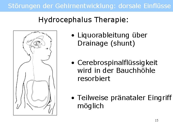 Störungen der Gehirnentwicklung: dorsale Einflüsse Hydrocephalus Therapie: • Liquorableitung über Drainage (shunt) • Cerebrospinalflüssigkeit