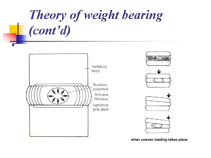 Theory of weight bearing (cont’d) 