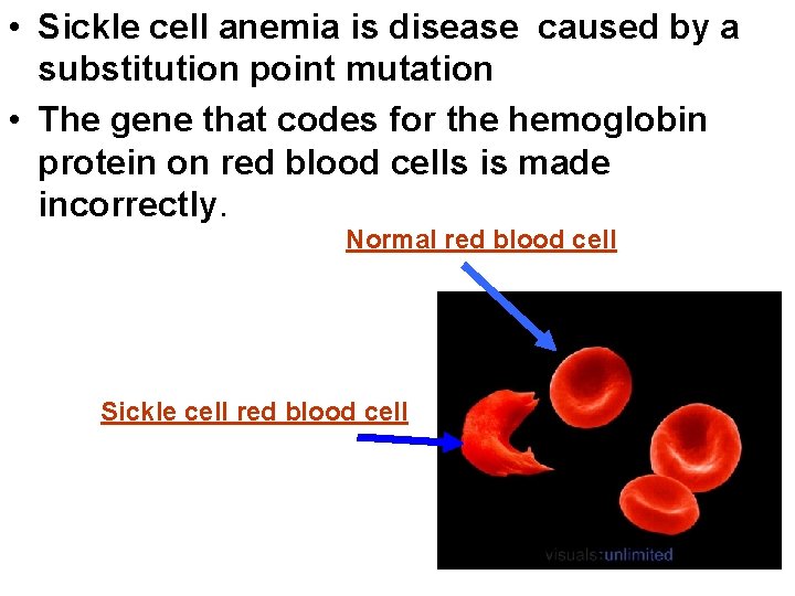  • Sickle cell anemia is disease caused by a substitution point mutation •