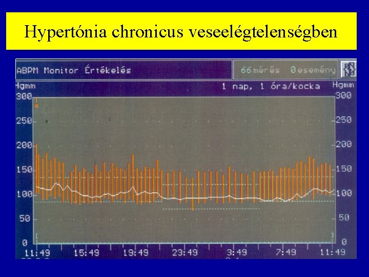 Hypertónia chronicus veseelégtelenségben 