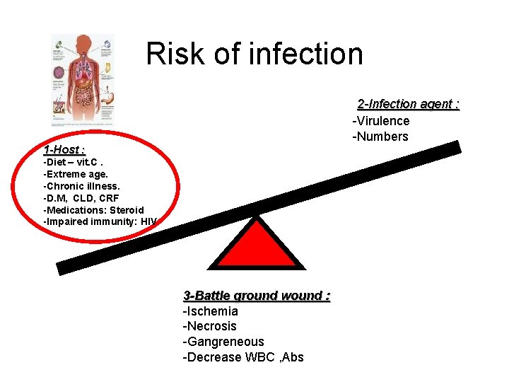 Risk of infection 2 -Infection agent : -Virulence -Numbers 1 -Host : -Diet –