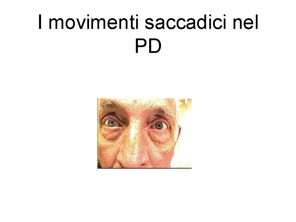 I movimenti saccadici nel PD 