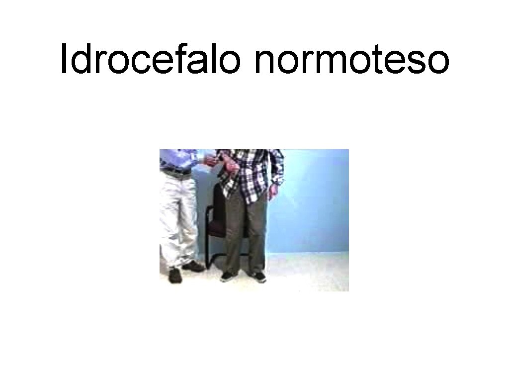 Idrocefalo normoteso 