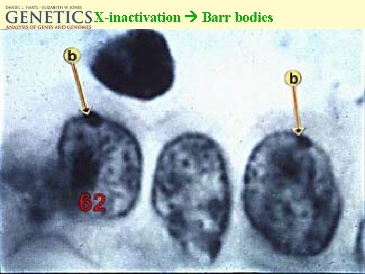 X-inactivation Barr bodies 