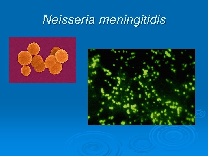 Neisseria meningitidis 