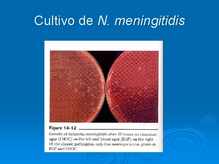 Cultivo de N. meningitidis 